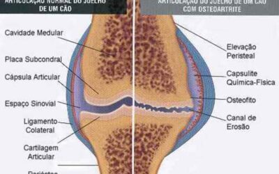 Doença articular: uso de Condroitina e Glucosamina